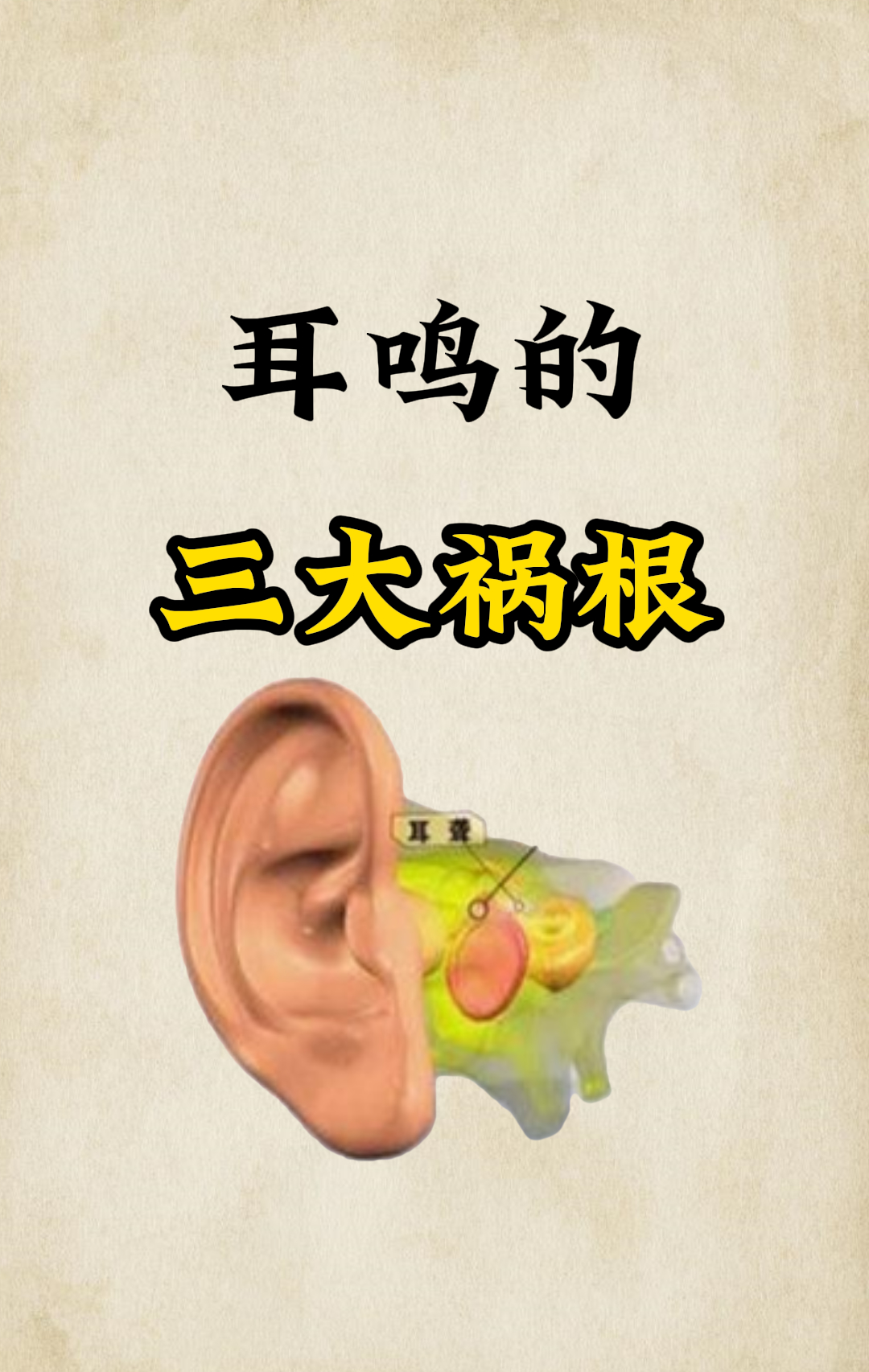 肾虚耳鸣的表现