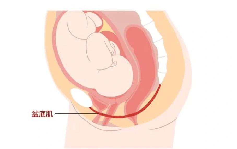 什么是阴吹