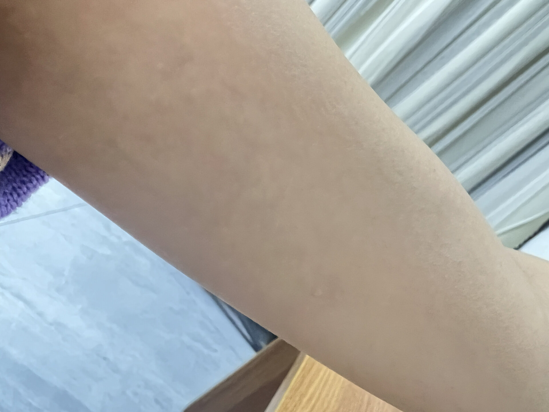 皮下埋植避孕效果好吗?