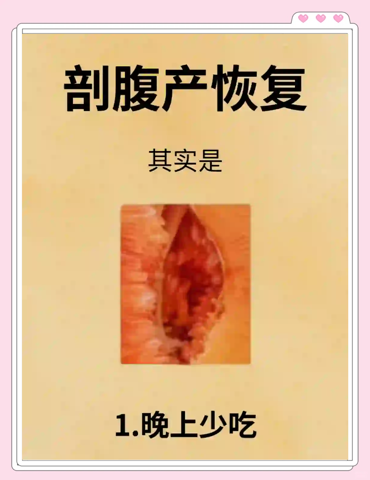剖腹产后多久能恢复,