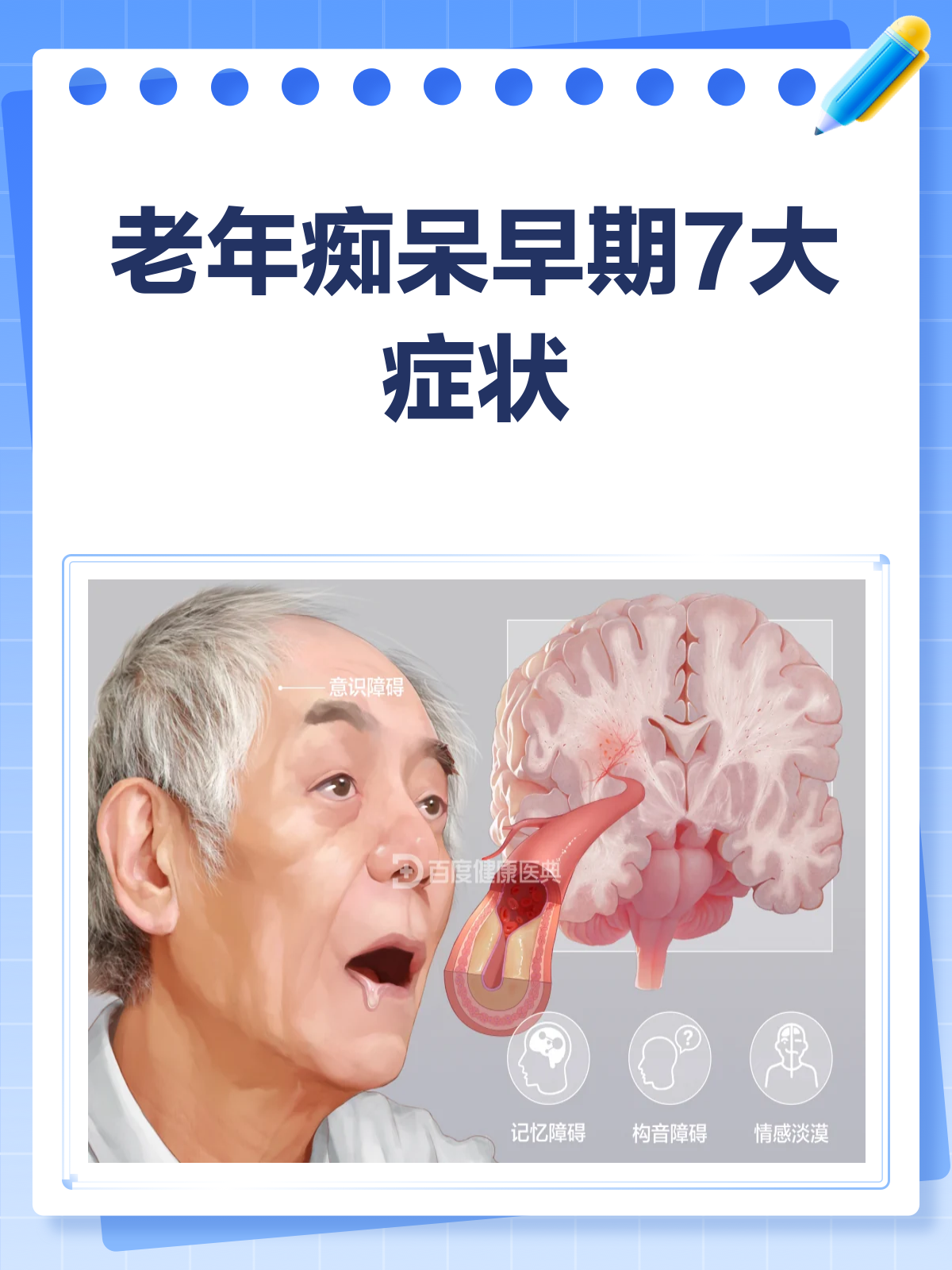 老年痴呆症有哪些表现