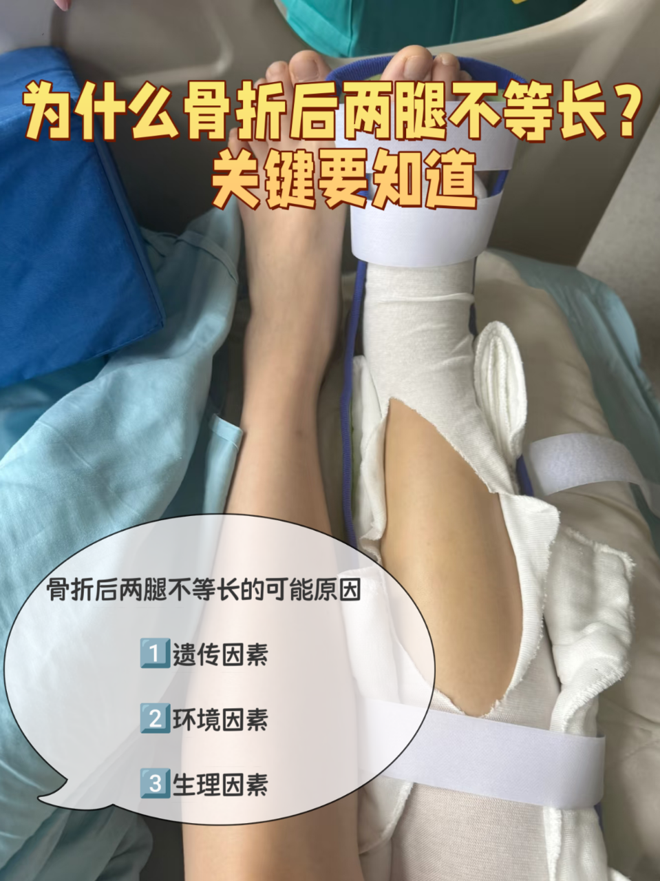 骨头错位多少天可以好