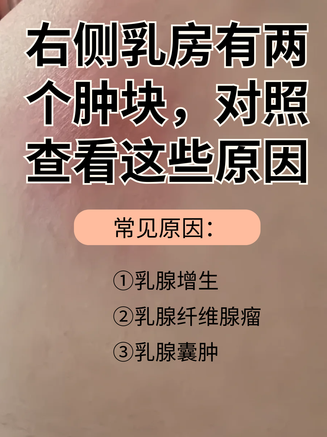 乳房有硬块怎么处理