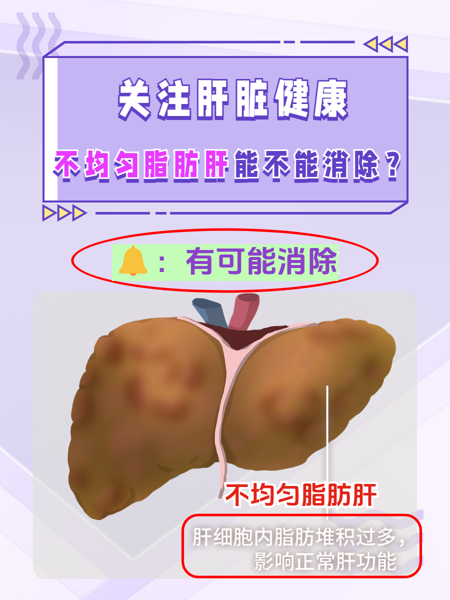 得了脂肪肝该怎么办