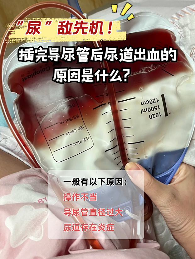 小便出血是怎么回事