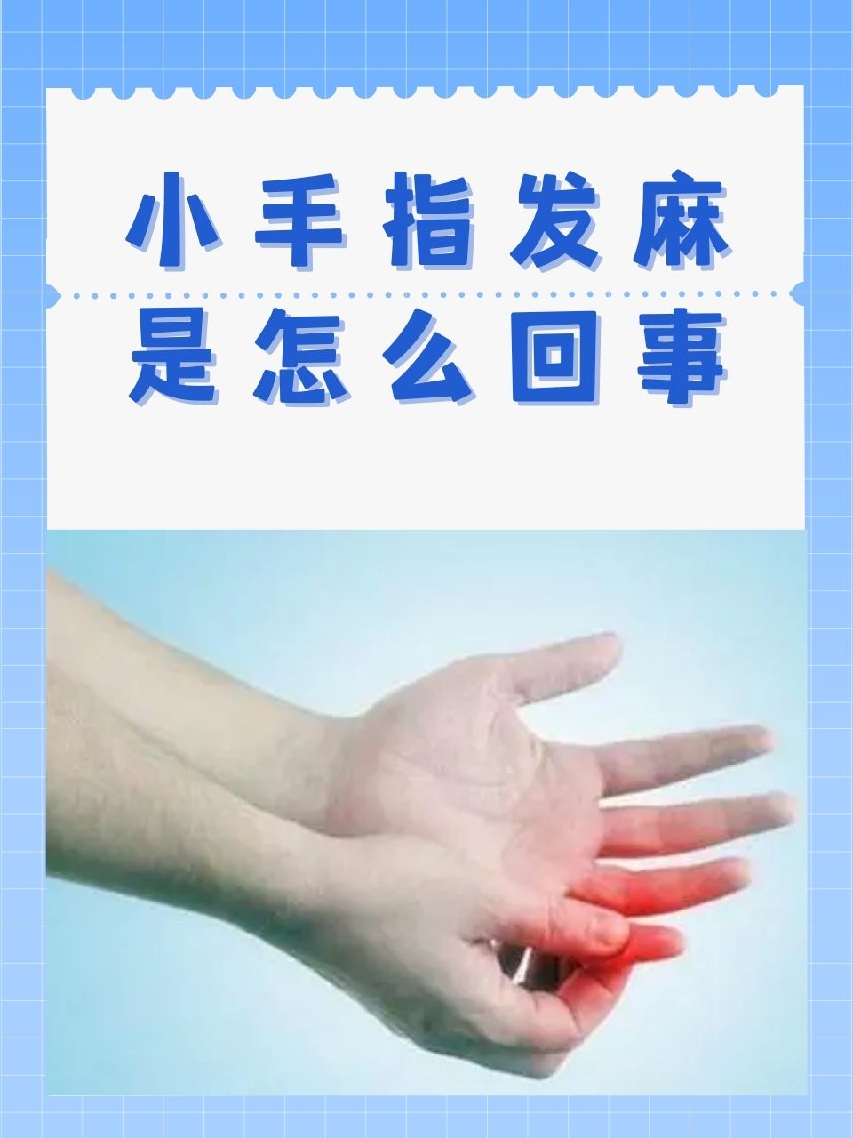 左手发麻是怎么回事.
