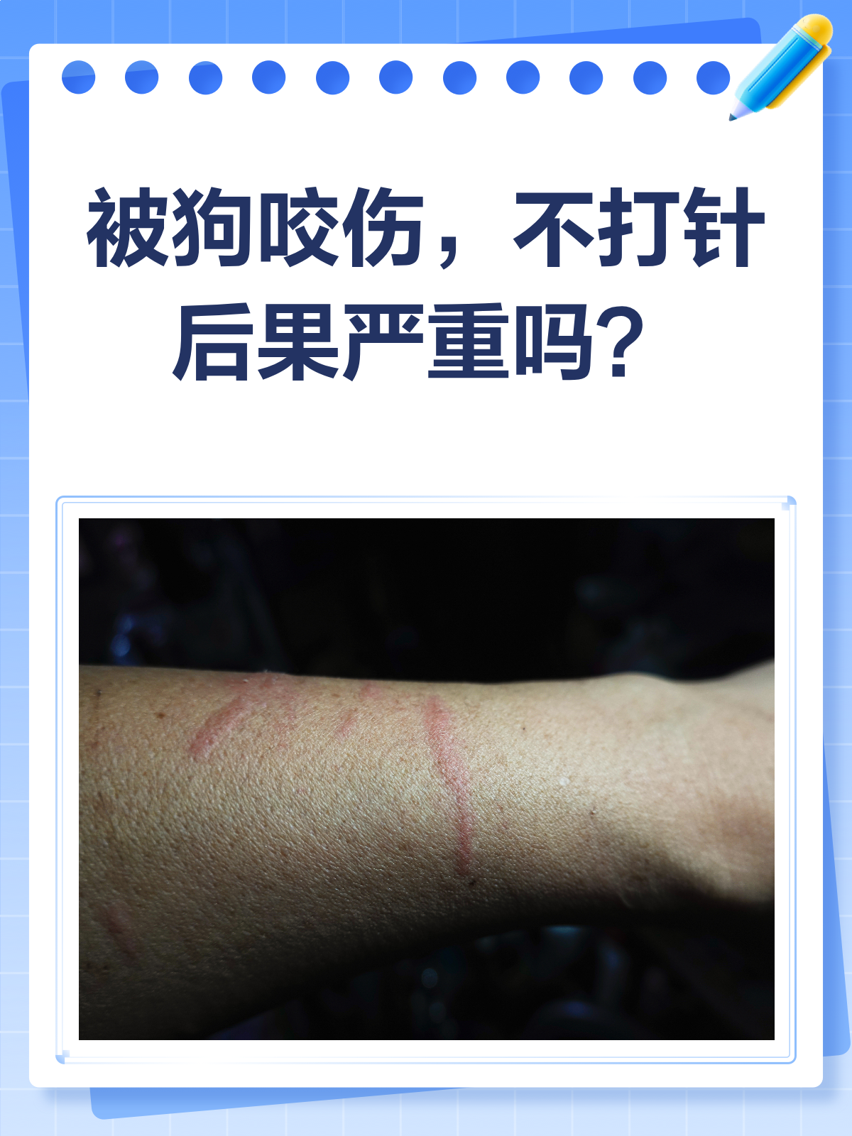 怎么确定是不是被狗咬了