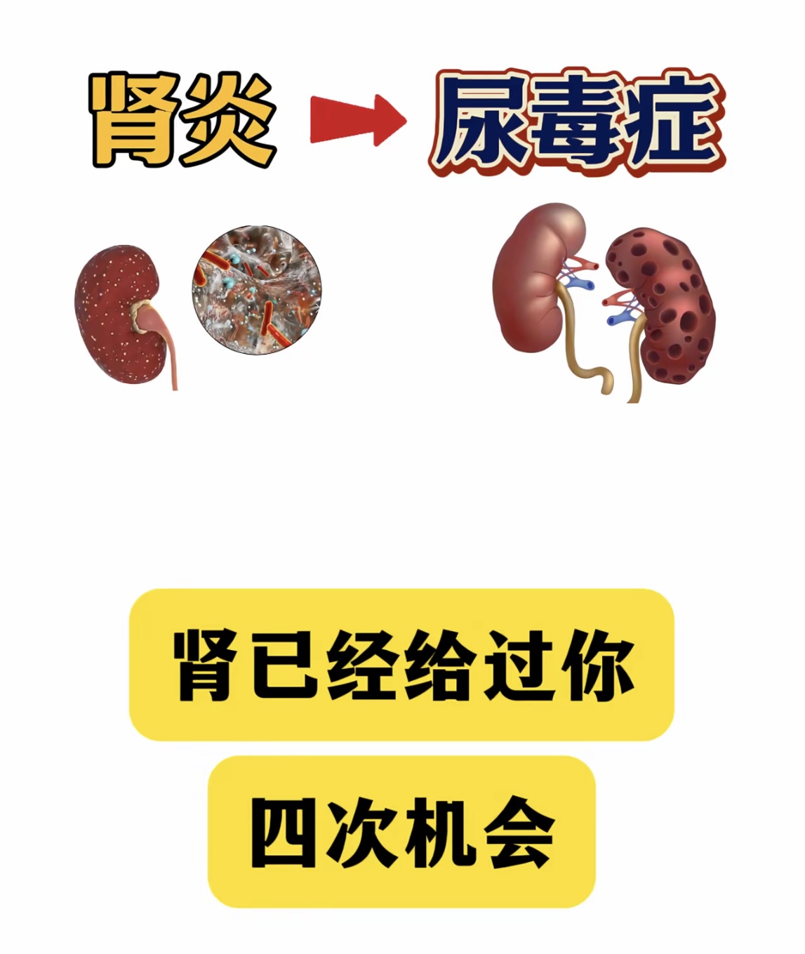 什么是肾炎
