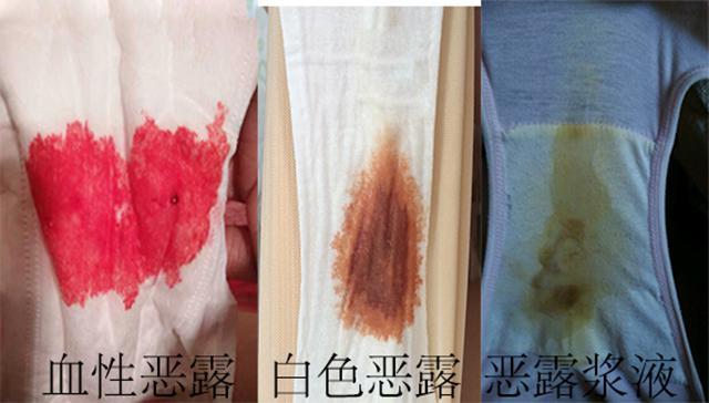 恶露是什么颜色的?
