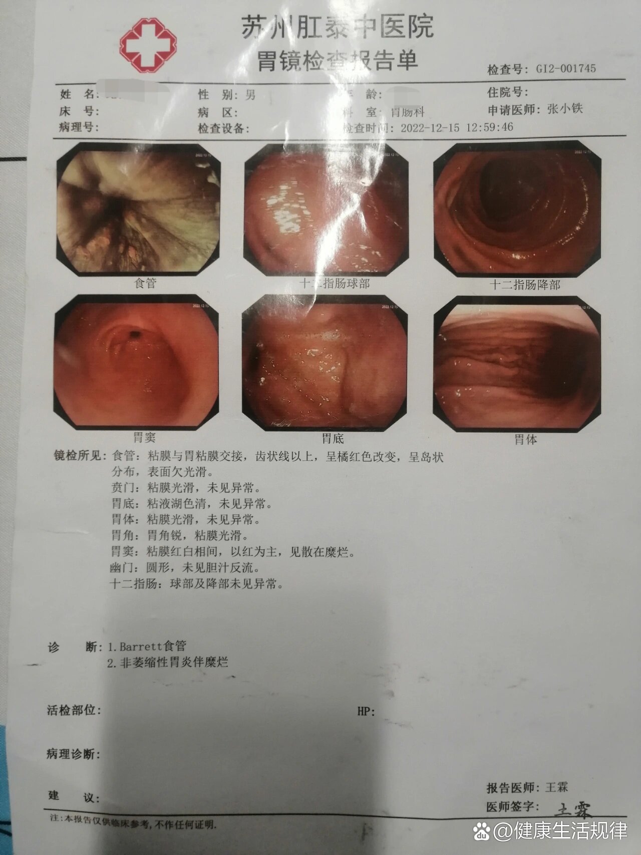 胃多发息肉的最坏结果