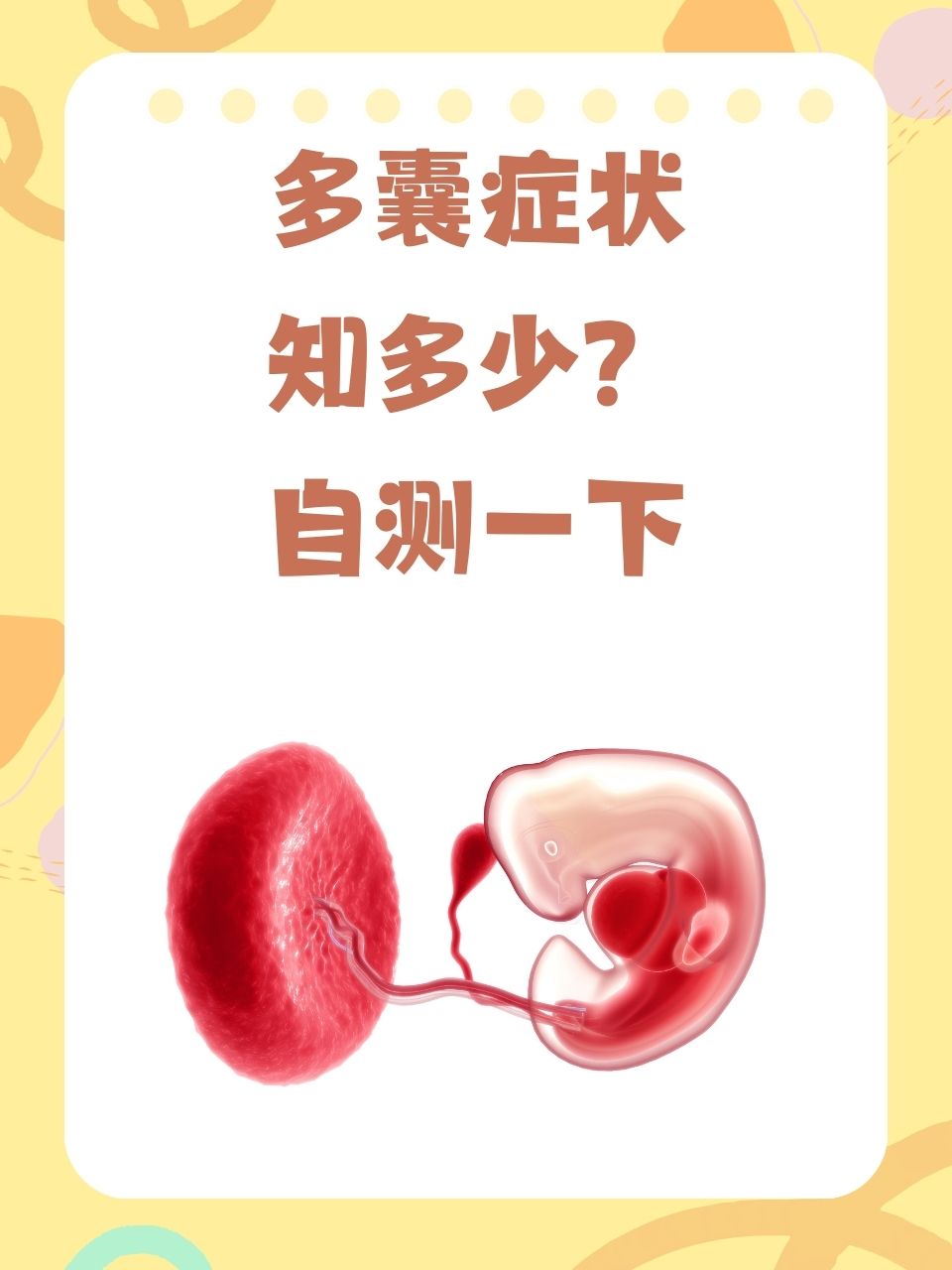 多囊卵巢是怎么引起的