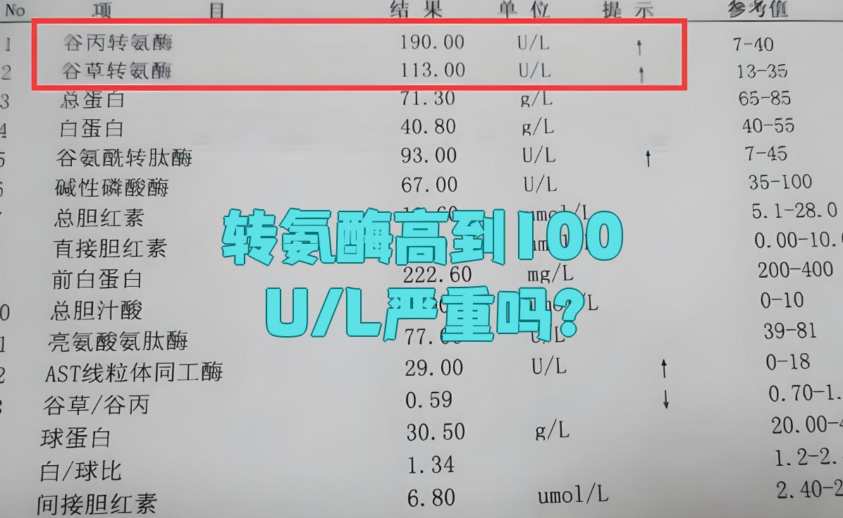 血清丙氨酸氨基转移酶值偏高