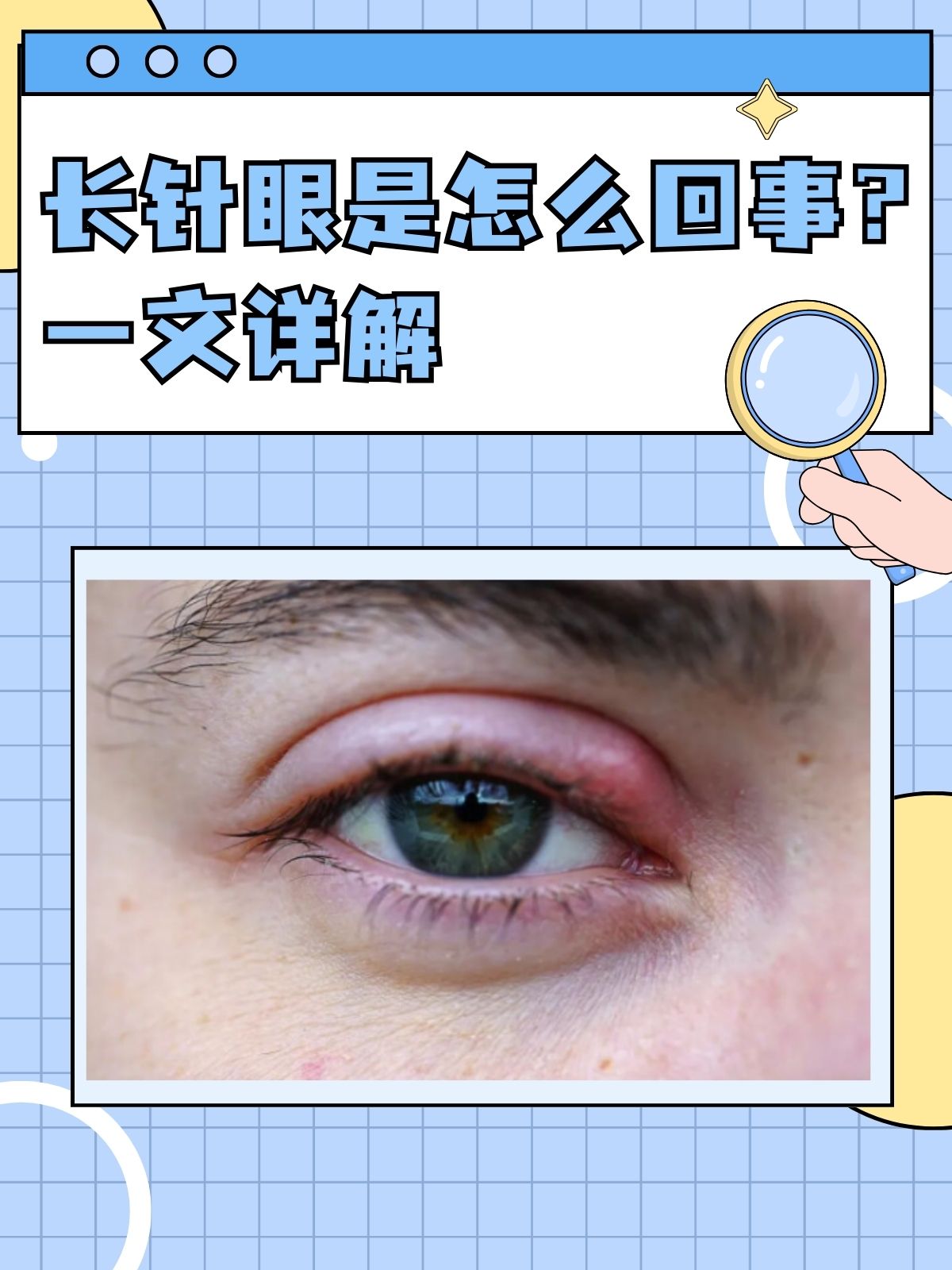 针眼的症状及治疗