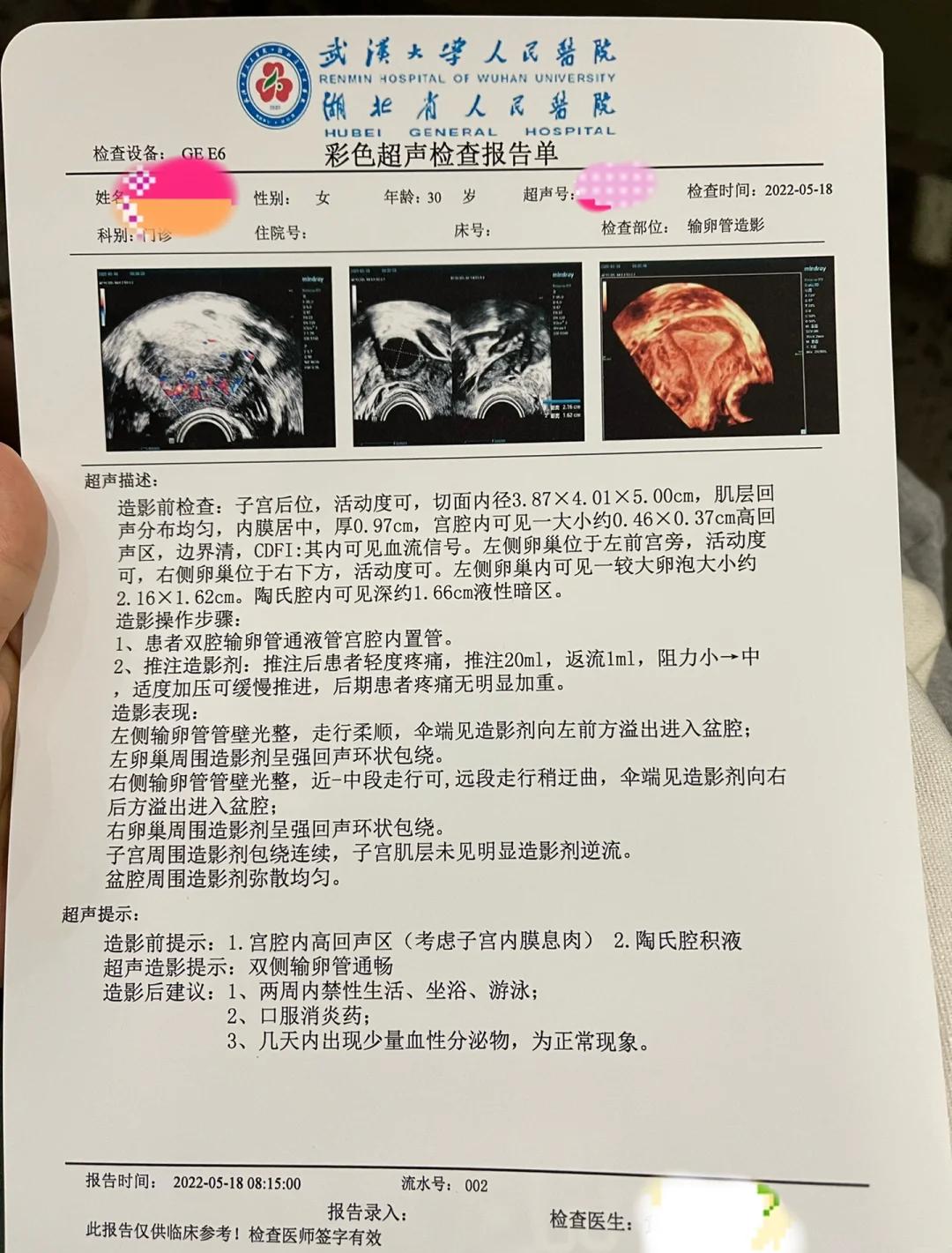 做造影疼吗