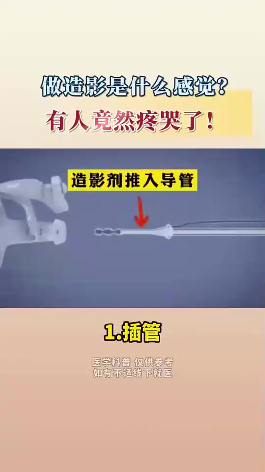 做造影疼吗