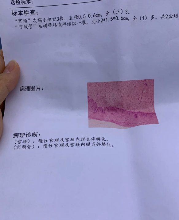 白带带血怎么回事
