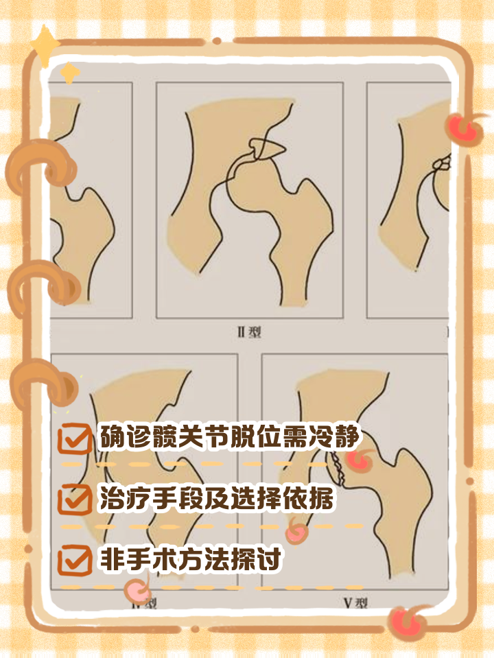 膝盖脱臼的治疗方法