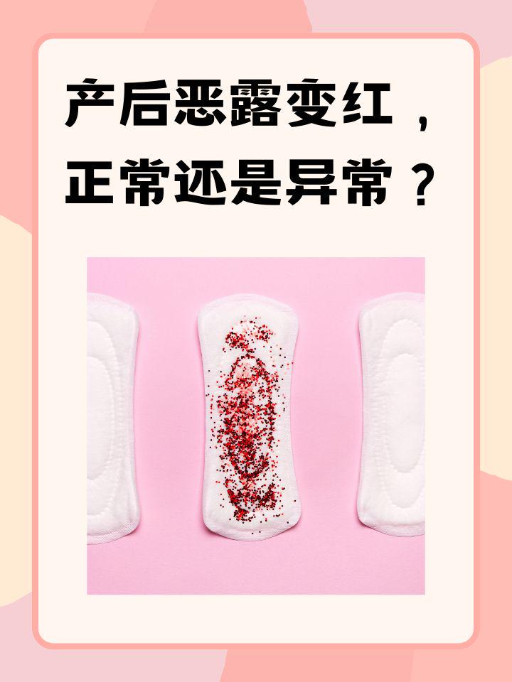 产后恶露是什么?