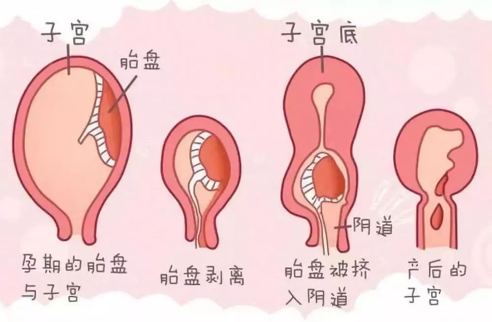 产后恶露是什么?
