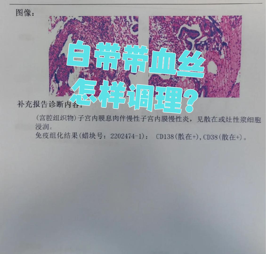 同房后白带有血丝,怎么回事?