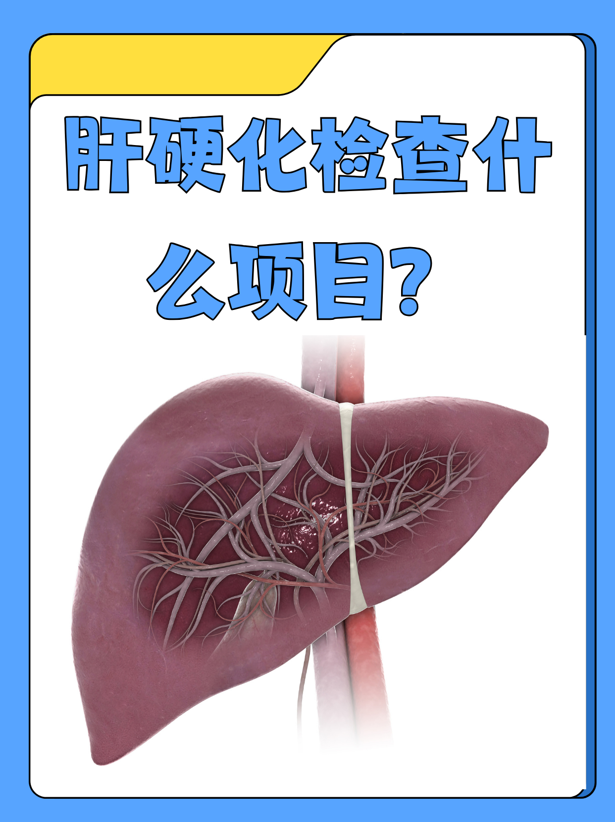 肝硬化是什么原因造成的