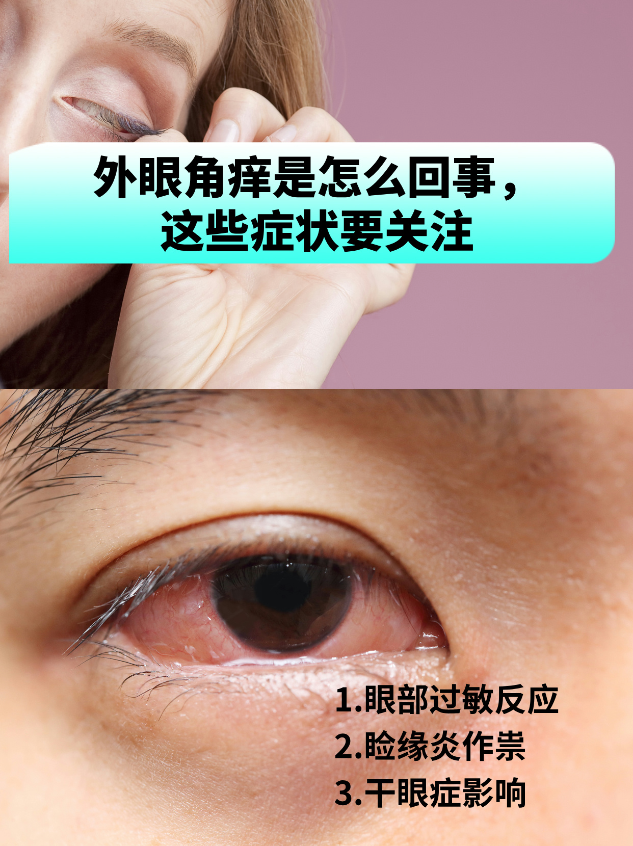 外眼角疼按压眨眼疼.