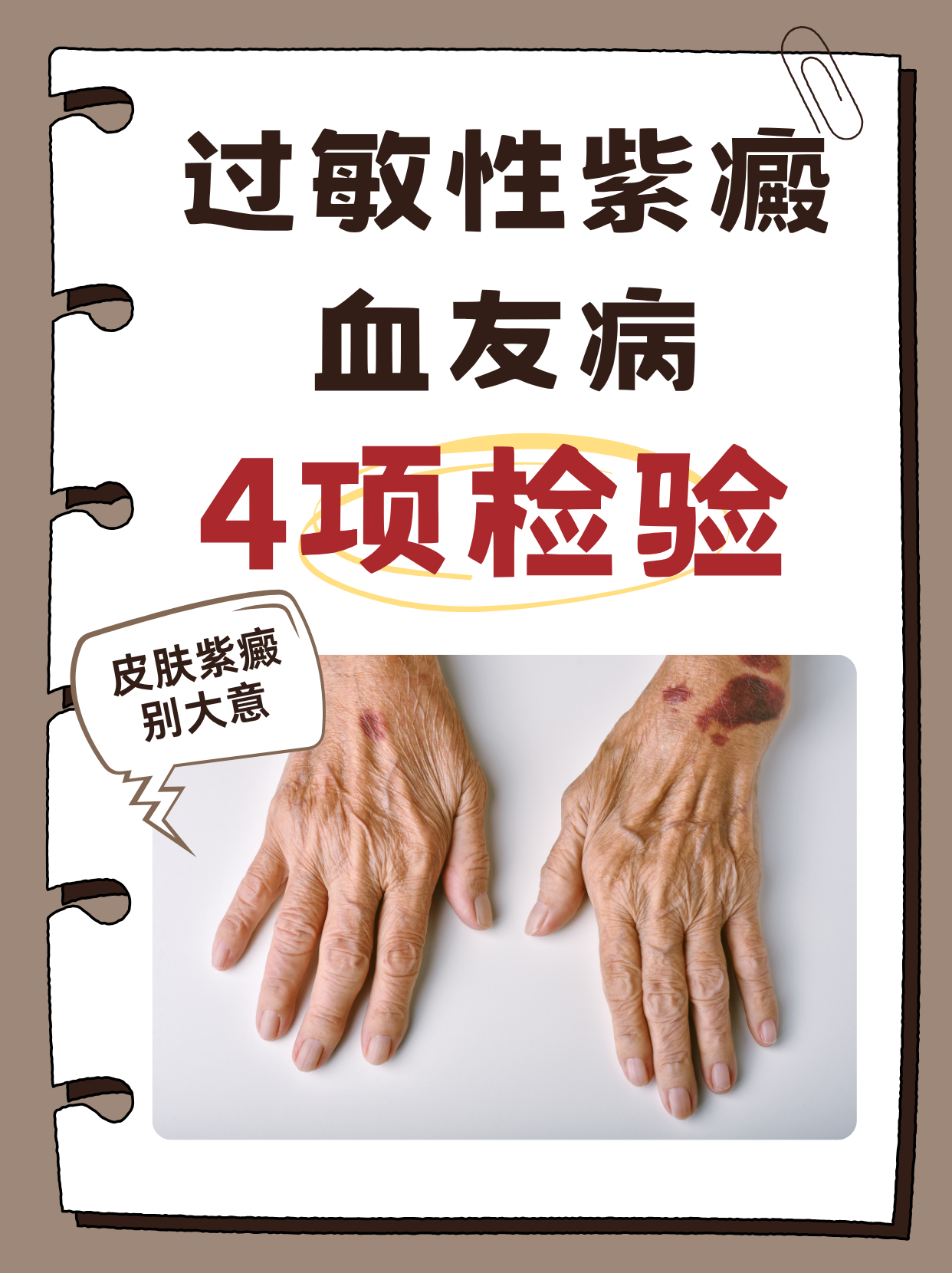 紫癜的治疗