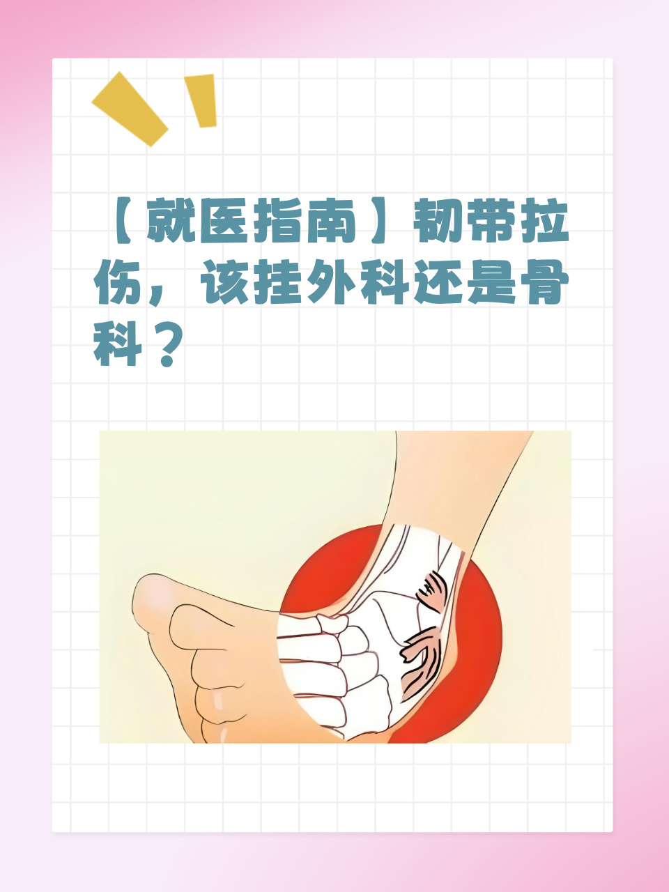 韧带拉伤一般多长时间能好