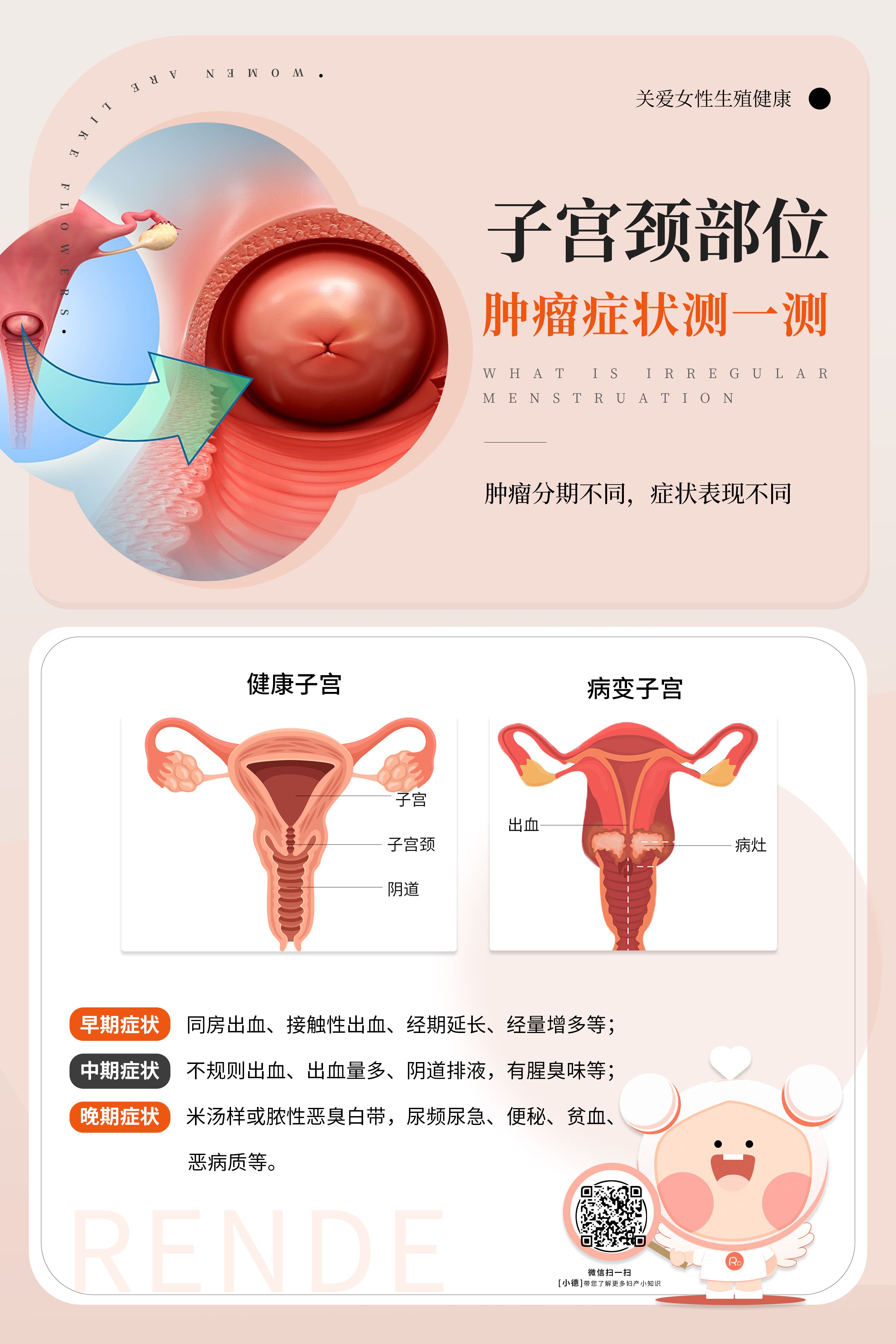 什么是子宫肉瘤?