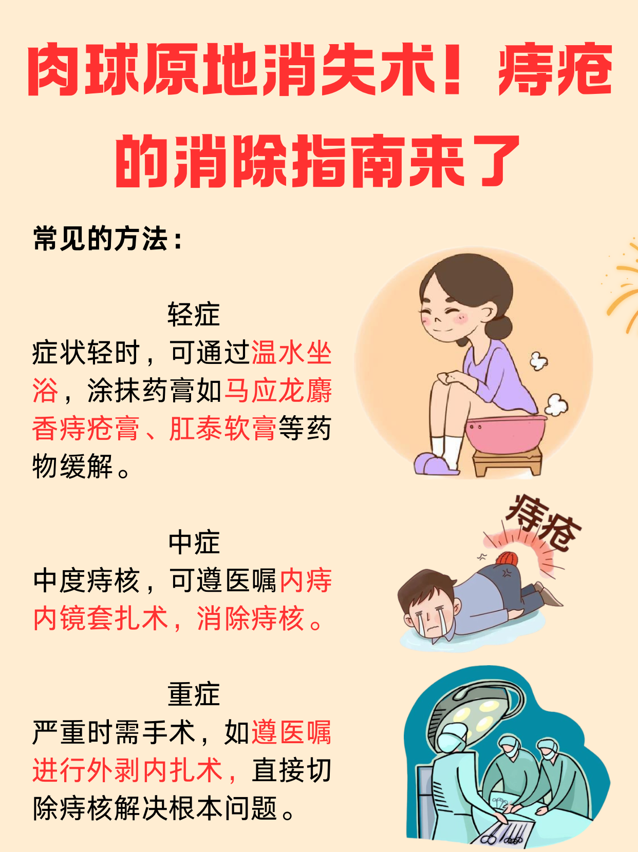 痔疮手术后注意事项有哪些