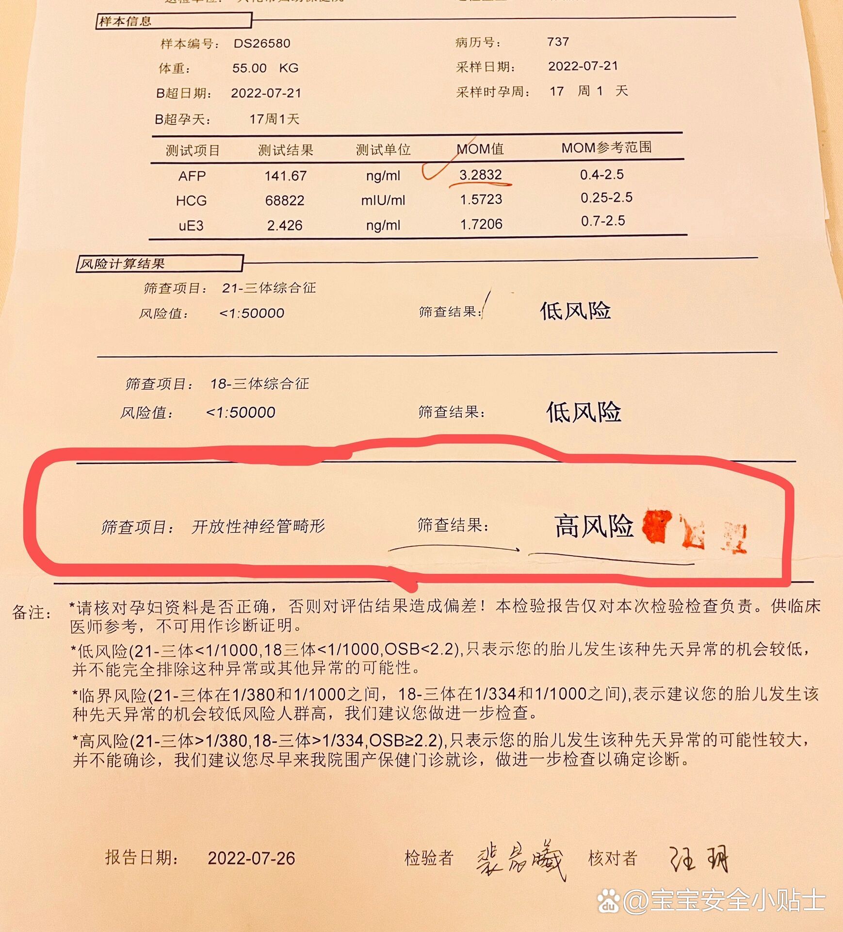 唐氏筛查高风险可怕吗