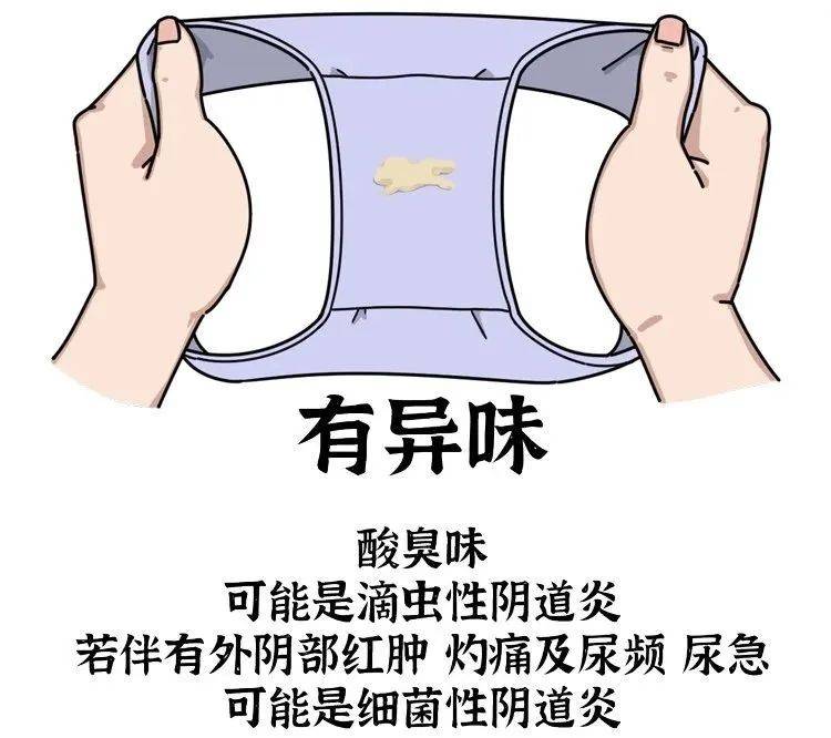 萎缩性阴道炎