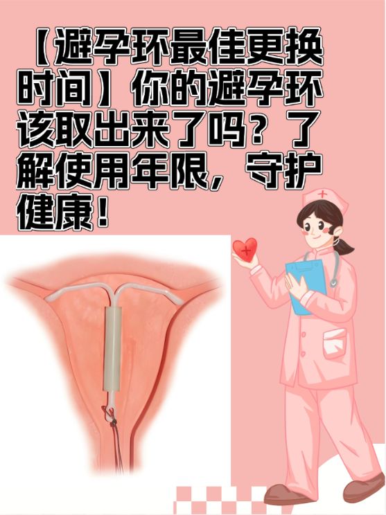 节育环避孕