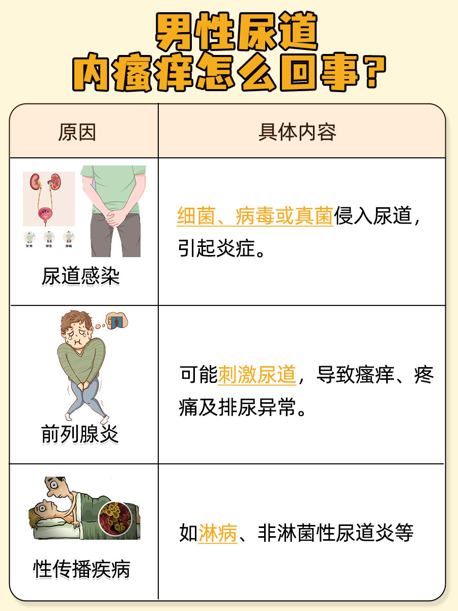 哪些属于男性尿道炎症状?