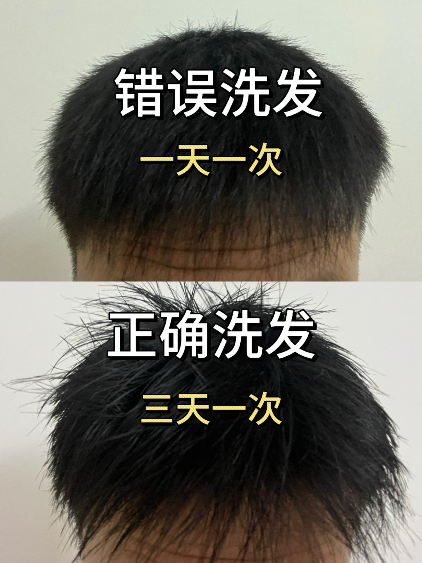 头发干燥,枯黄怎么办?