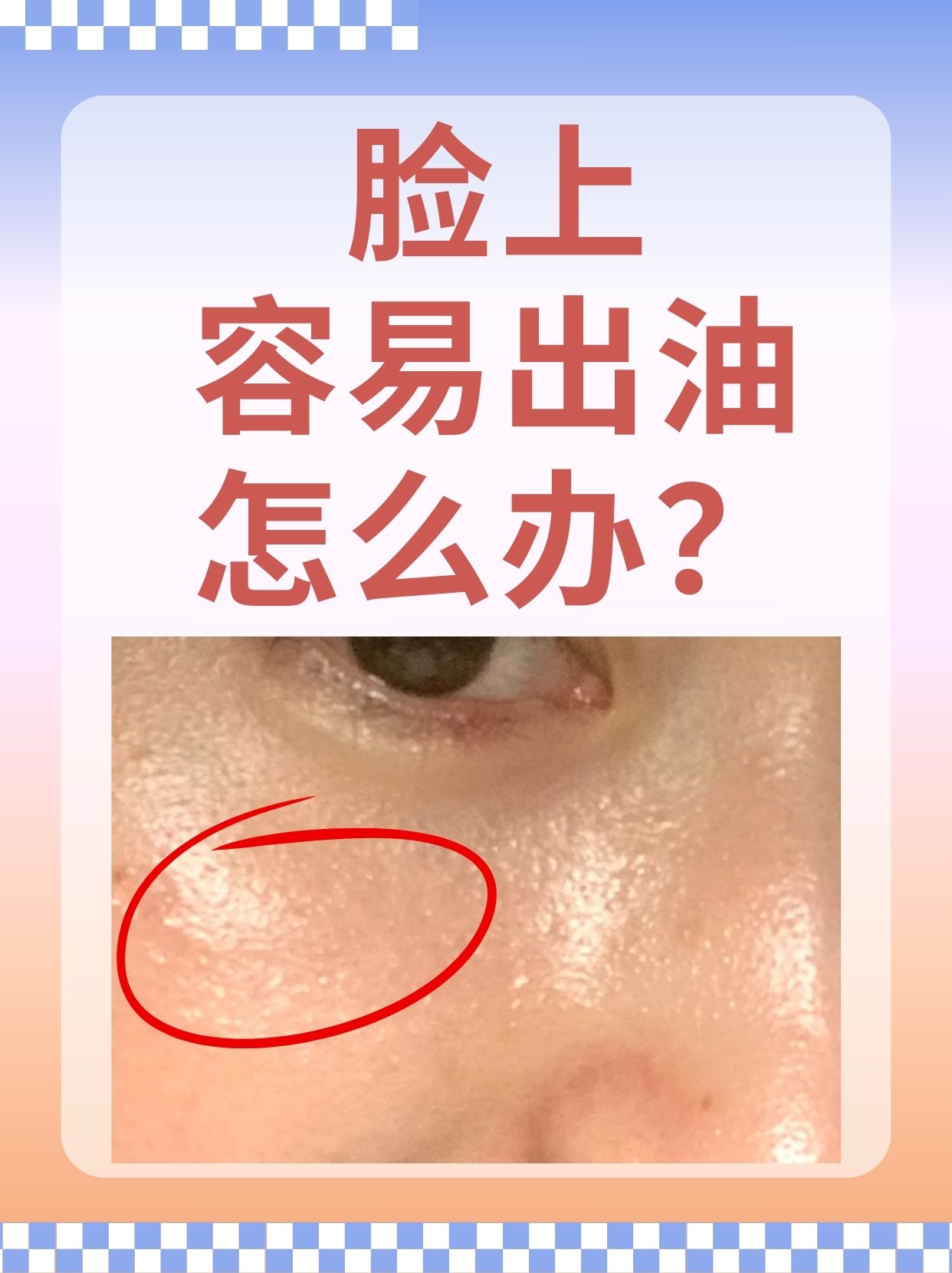早上起来脸部出油是怎么回事