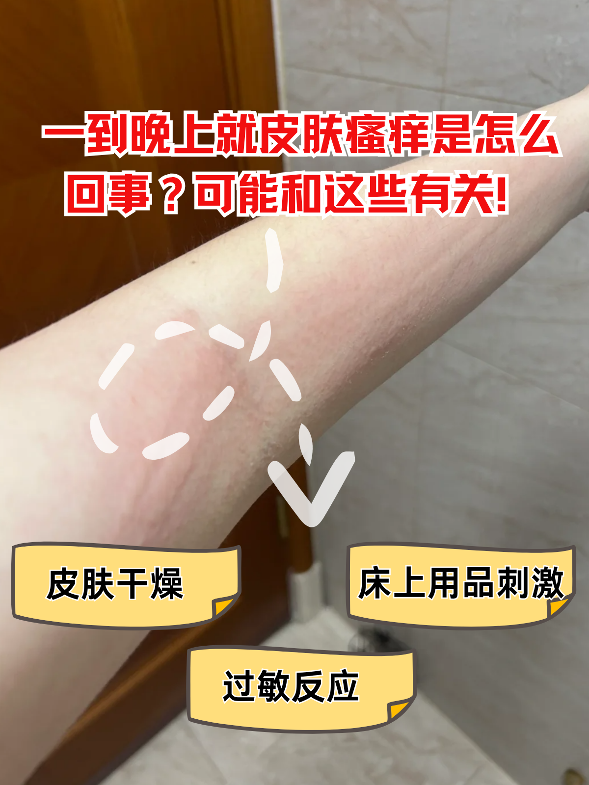 一到晚上皮肤发痒怎么办
