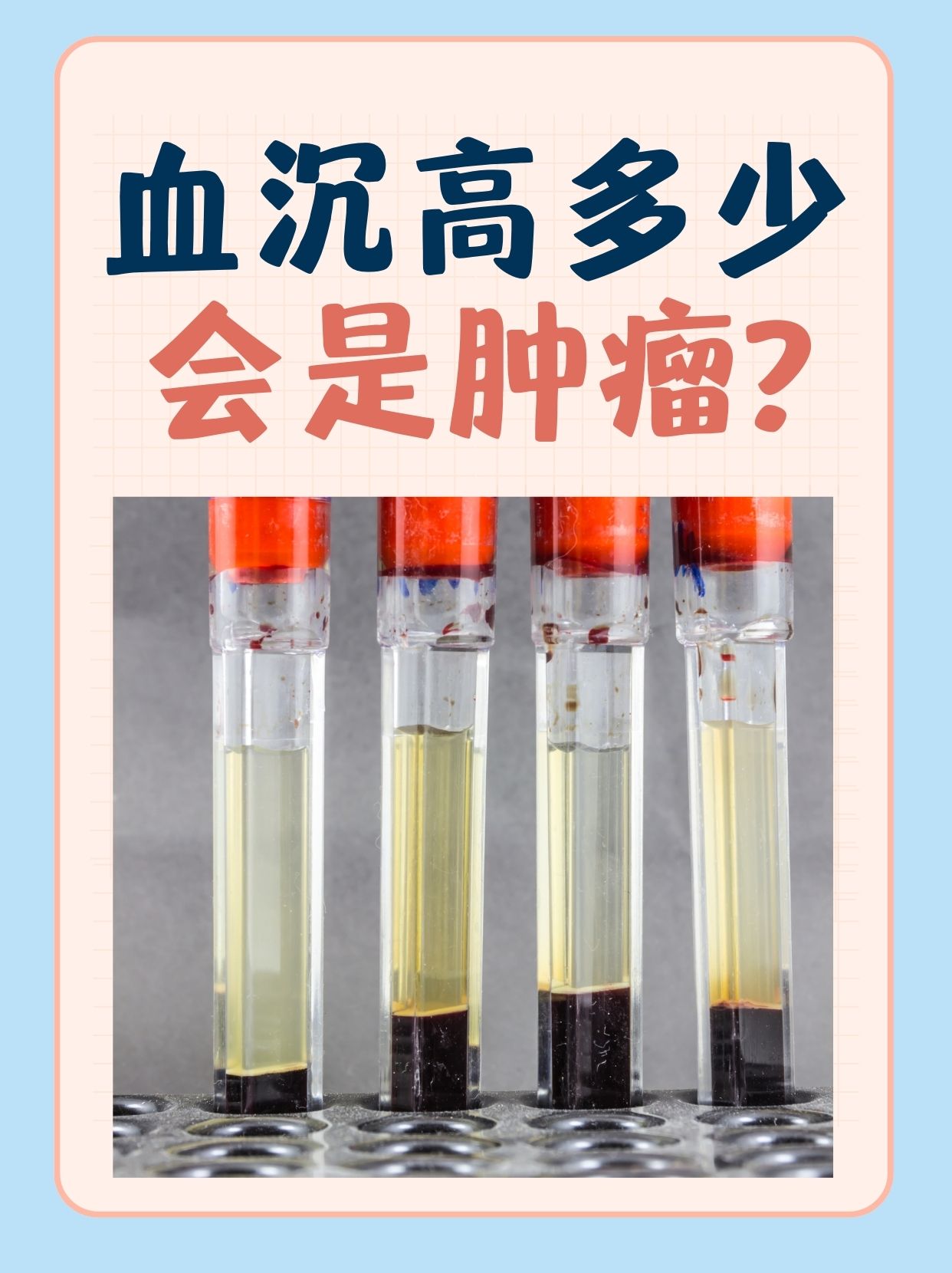 血沉多少正常