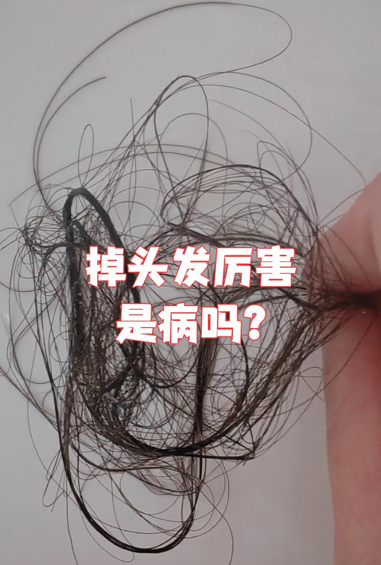脱发断发是怎么回事