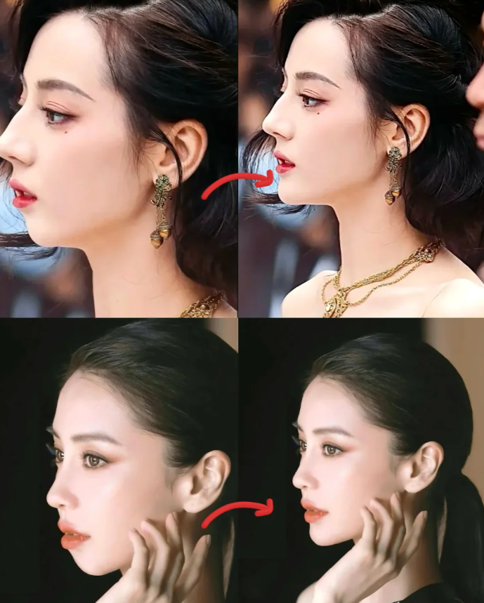 侧脸看嘴巴有点前突,正面看的话没有那么明显