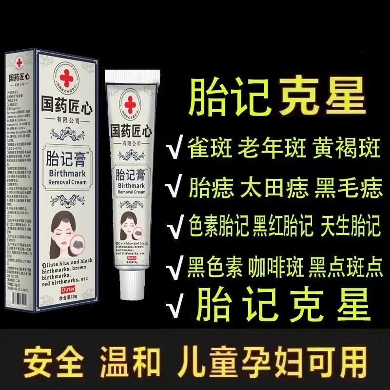 黑色胎记很危险吗