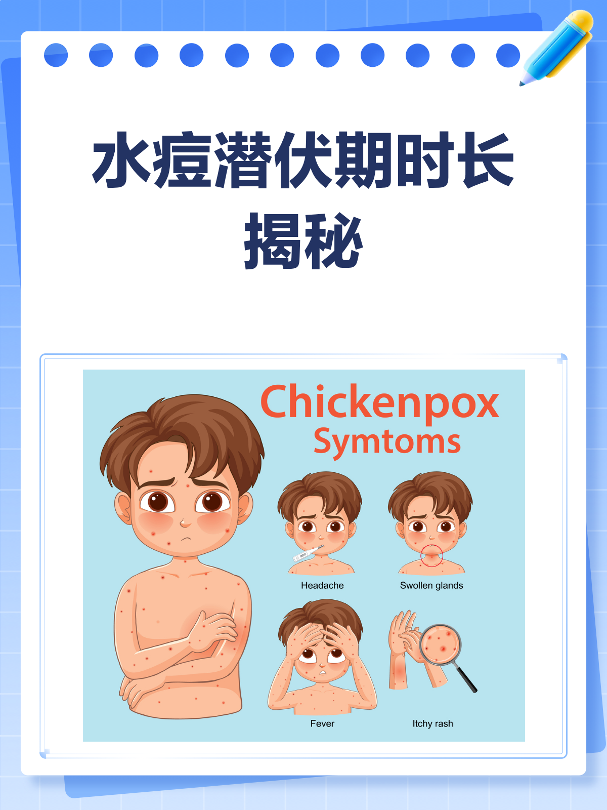 水痘的潜伏期