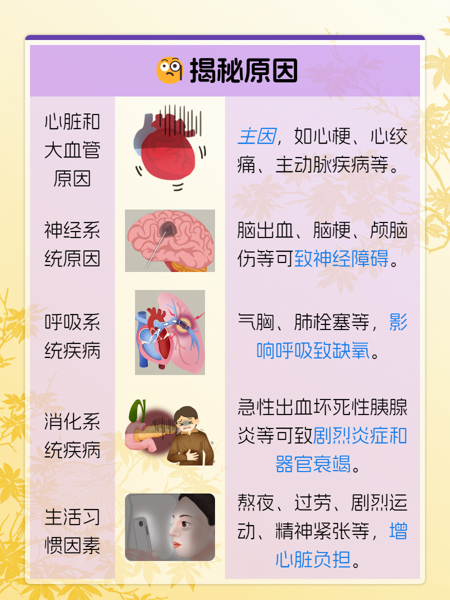 心源性猝死的原因