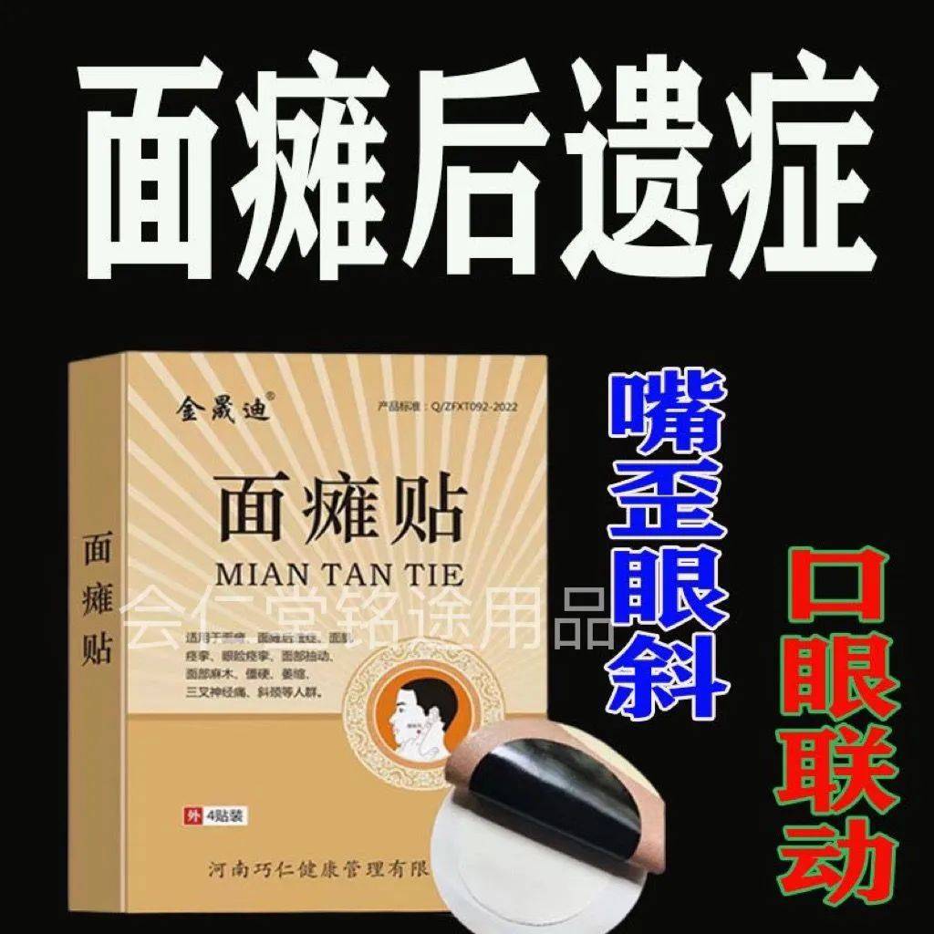 面神经炎多久能好