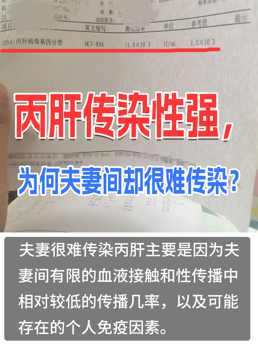 丙肝潜伏期症状??