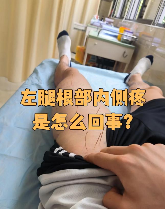 大腿内侧疼痛如何治疗