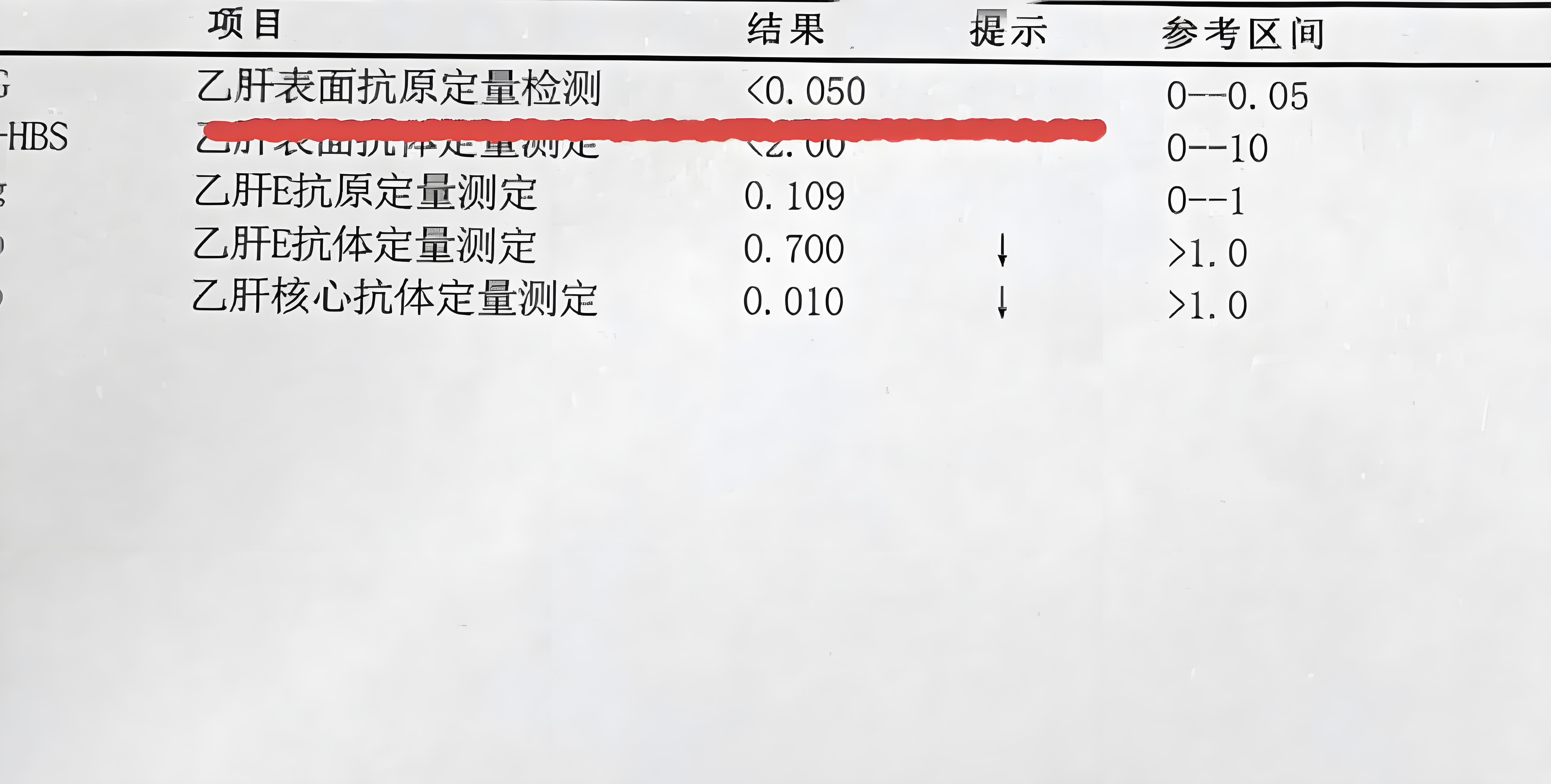 乙肝表面抗原是什么