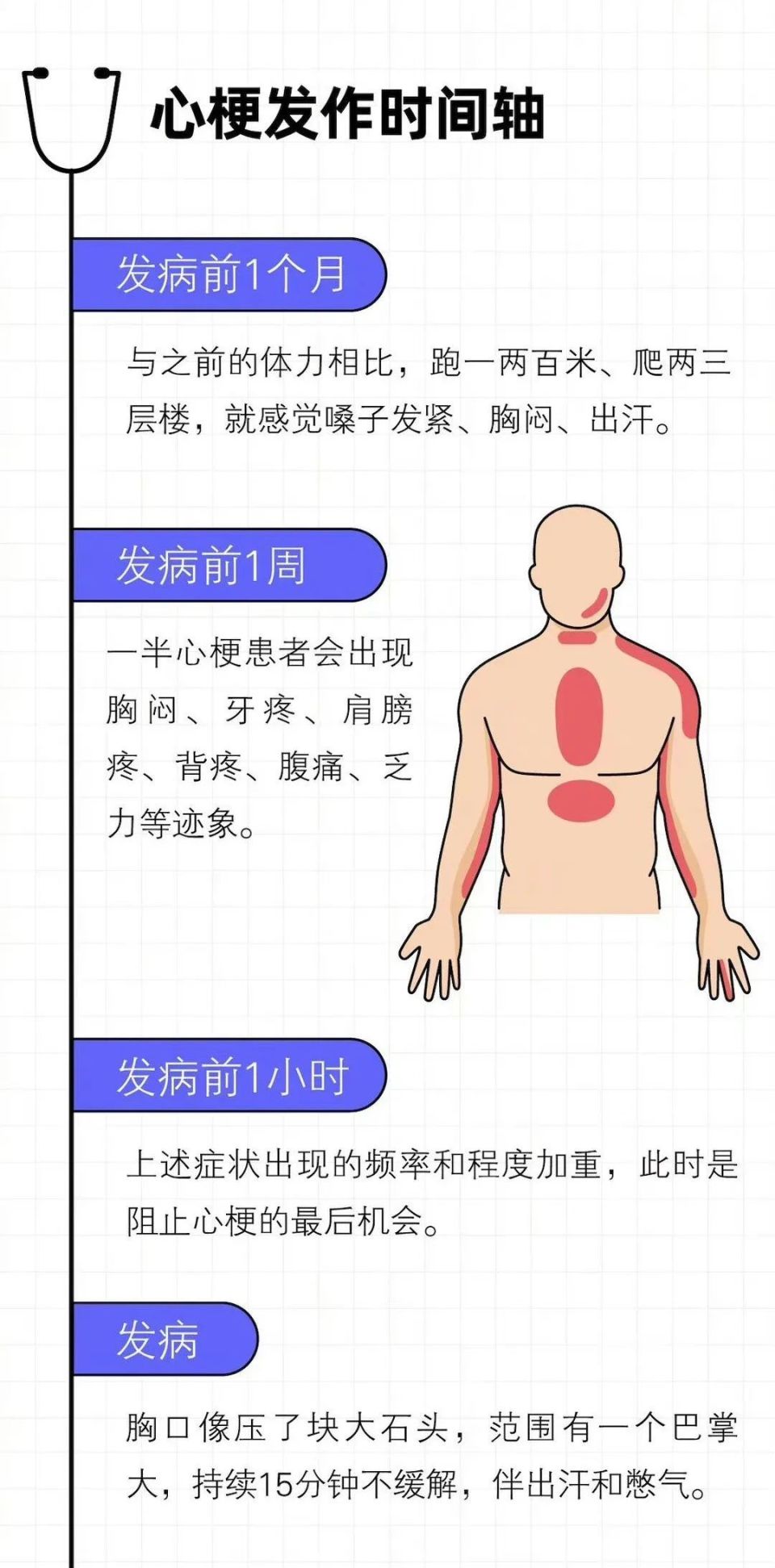 心肌梗死的并发症有哪些