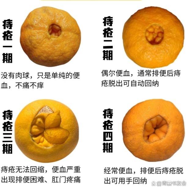什么是痣疮