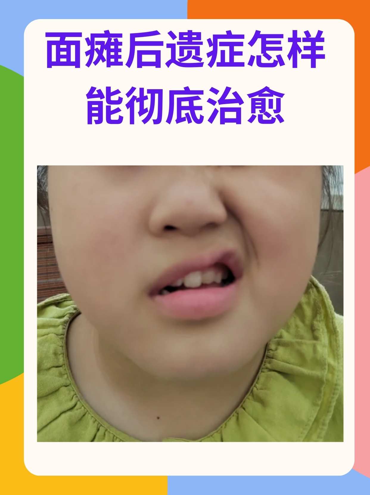 治疗面瘫的土方法